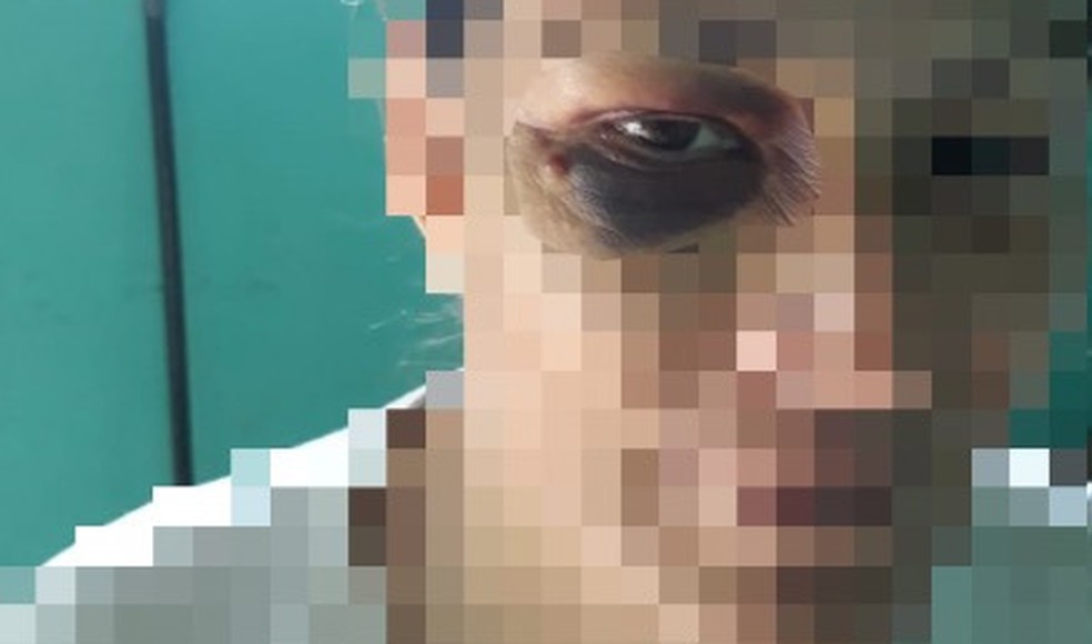 Mulher busca na Justiça a prisão do companheiro após ser espancada e baleada no interior do TO