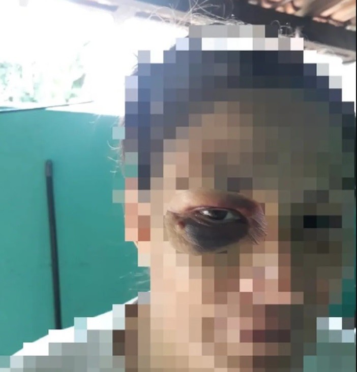 Preso por espancar e atirar na nuca da própria mulher é solto da cadeia por falha da Justiça, diz advogada